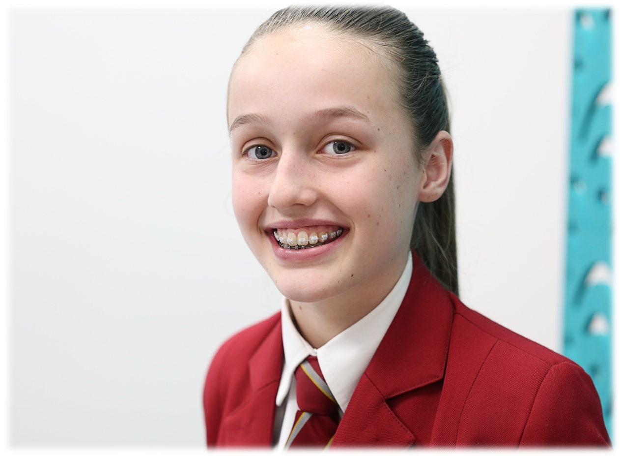 Clearbraces1